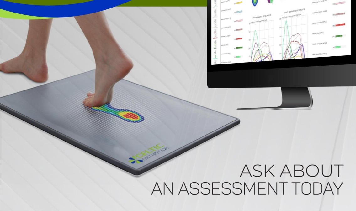 Foot scan technology showing pressure mapping of a patient's foot on a scanner, with results displayed on a monitor